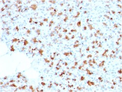 Biotium&nbsp;BARX1 (Prognostic Biomarker in Hepatocellular Carcinoma)(BARX1/2759), CF594 conjugate, 0.1mg/mL