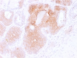 Biotium&nbsp;CD44v6 (Marker of Tumor Metastasis)(CD44V6/2496), CF594 conjugate, 0.1mg/mL