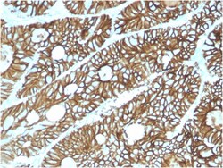 Biotium&nbsp;Cadherin 17 / LI Cadherin (Liver-Intestine Marker)(CDH17/2615), CF740 conjugate, 0.1mg/mL
