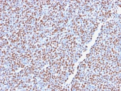 Biotium&nbsp;ALK (Anaplastic Lymphoma Kinase) / CD246(ALK1/2766R), Biotin conjugate, 0.1mg/mL
