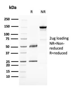 Biotium&nbsp;BAP1 (BRCA1 Associated Protein 1)(BAP1/2667), 0.2mg/mL