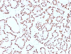 Biotium&nbsp;Cyclin D1 (G1-Cyclin & Mantle Cell Lymphoma Marker)(CCND1/2593), Biotin conjugate, 0.1mg/mL