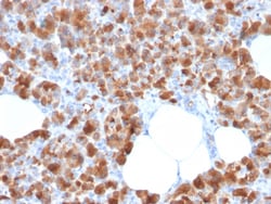 Biotium&nbsp;Carboxypeptidase A1 / CPA1 (Pancreatic Cancer Marker)(CPA1/2713), Biotin conjugate, 0.1mg/mL