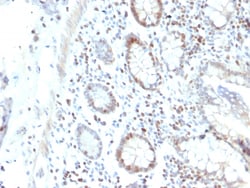 Biotium&nbsp;RAD51 (Prognostic and Response to Chemotherapy Marker)(RAD51/2702), CF594 conjugate, 0.1mg/mL