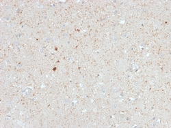 Biotium&nbsp;Calretinin / Calbindin 2 (Mesothelioma Marker)(CALB2/2603), CF647 conjugate, 0.1mg/mL
