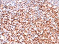Biotium&nbsp;CD73 (Immuno-Oncology Target)(NT5E/2646), CF647 conjugate, 0.1mg/mL