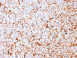 Biotium&nbsp;Mammaglobin (SCGB2A2) (Breast Cancer Marker)(MGB1/2682R), CF640R conjugate, 0.1mg/mL