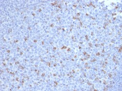 Biotium&nbsp;PDCD1 / PD1 / CD279 (Programmed Cell Death 1)(PDCD1/2720), CF640R conjugate, 0.1mg/mL