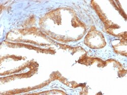 Biotium&nbsp;YBX1 / Y-box Binding Protein 1 / YB-1 (Tumor Biomarker)(rYBX1/2430), CF647 conjugate, 0.1mg/mL