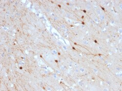 Biotium&nbsp;Calretinin / Calbindin 2 (Mesothelioma Marker)(CALB2/2685), CF647 conjugate, 0.1mg/mL