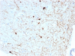 Biotium&nbsp;Calretinin / Calbindin 2 (Mesothelioma Marker)(CALB2/2786), CF647 conjugate, 0.1mg/mL