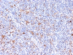 Biotium&nbsp;RCAS1 / Estrogen Receptor Binding Site Associated, Antigen 9(CPTC-EBAG9-2), CF640R conjugate, 0.1mg/mL