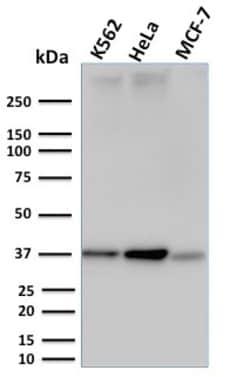 Biotium&nbsp;RAD51 (Prognostic and Response to Chemotherapy Marker)(RAD51/2753), CF405S conjugate, 0.1mg/mL