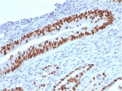 Biotium&nbsp;p53 (Tumor Suppressor Protein)(TP53/2719), CF640R conjugate, 0.1mg/mL