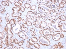 Biotium&nbsp;NKX3.1 (Metastatic Prostate Adenocarcinoma Marker)(NKX3.1/2836), CF568 conjugate, 0.1mg/mL