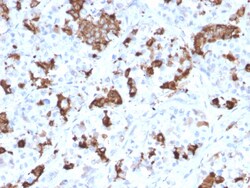Biotium&nbsp;Prolactin (Pituitary Tumor Marker)(PRL/2644), CF640R conjugate, 0.1mg/mL