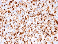 Biotium&nbsp;NGF-Receptor (p75) / CD271 (Soft Tissue Tumor Marker)(rNGFR/1965), CF405S conjugate, 0.1mg/mL