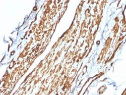 Biotium&nbsp;Vinculin (Marker of Age-related Macular Degeneration)(VCL/2575), CF405S conjugate, 0.1mg/mL