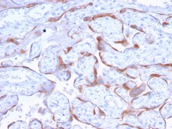 Biotium PAPP-A / Pappalysin-1 (Marker of Atherosclerosis and Aneuploid