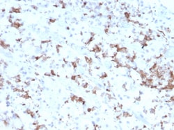Biotium&nbsp;Prolactin (Pituitary Tumor Marker)(PRL/2641), CF647 conjugate, 0.1mg/mL
