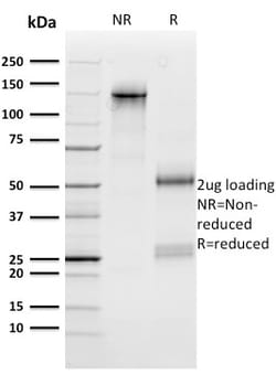 Biotium&nbsp;n-Myc (Neuroblastoma Marker)(NMYC-1), CF647 conjugate, 0.1mg/mL