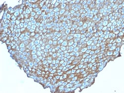 Biotium&nbsp;Desmoglein-3 (Squamous Cell Marker)(DSG3/2838), CF640R conjugate, 0.1mg/mL