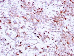 Biotium&nbsp;Cathepsin K (Marker of Tumor Invasiveness)(CTSK/2791), CF405S conjugate, 0.1mg/mL