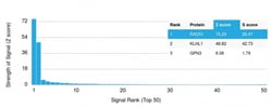 Biotium&nbsp;RAD51 (Prognostic and Response to Chemotherapy Marker)(RAD51/2701), CF640R conjugate, 0.1mg/mL
