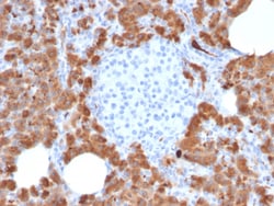 Biotium&nbsp;Carboxypeptidase A1 / CPA1 (Pancreatic Cancer Marker)(CPA1/2714), CF640R conjugate, 0.1mg/mL