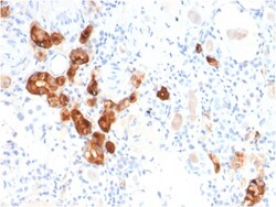 Biotium&nbsp;Calbindin 1 (CALB1)(CALB1/2782), CF640R conjugate, 0.1mg/mL