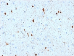 Biotium&nbsp;Calretinin / Calbindin 2 (Mesothelioma Marker)(CALB2/2602), CF640R conjugate, 0.1mg/mL