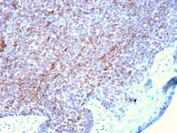 Biotium&nbsp;p73 (Tumor Suppressor)(P73/2531), CF647 conjugate, 0.1mg/mL