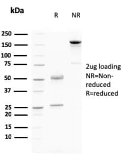 Biotium&nbsp;Desmoglein-3 (Squamous Cell Marker)(DSG3/2796), CF647 conjugate, 0.1mg/mL