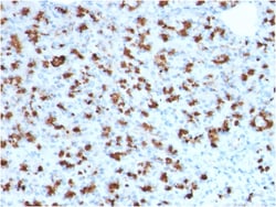 Biotium&nbsp;BARX1 (Prognostic Biomarker in Hepatocellular Carcinoma)(BARX1/2760), CF647 conjugate, 0.1mg/mL