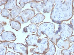 Biotium&nbsp;PAPP-A / Pappalysin-1 (Marker of Atherosclerosis and Aneuploid Fetus)(PAPPA/2716), CF640R conjugate, 0.1mg/mL