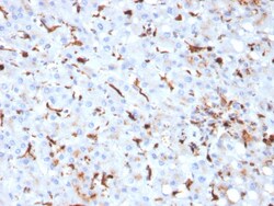 Biotium&nbsp;Cathepsin K (Marker of Tumor Invasiveness)(CTSK/2793), CF640R conjugate, 0.1mg/mL