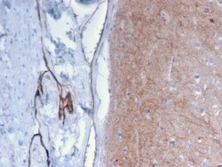 Biotium&nbsp;Drebrin 1 (DBN1)(DBN1/2879), CF640R conjugate, 0.1mg/mL