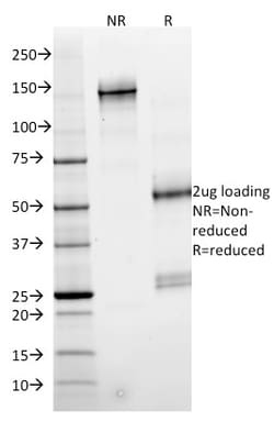 Biotium&nbsp;SMAD4 (Pancreatic Adenocarcinoma Marker)(SMAD4/2524), CF640R conjugate, 0.1mg/mL