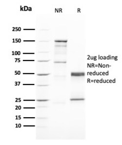 Biotium&nbsp;GATA-3 (Breast and Urothelial Marker)(GATA3/2446), CF640R conjugate, 0.1mg/mL