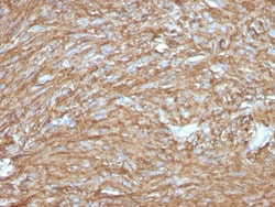 Biotium&nbsp;DOG-1 / TMEM16A (Gastrointestinal Stromal Tumor Marker)(DG1/2831R), CF405S conjugate, 0.1mg/mL