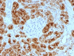 Biotium&nbsp;GP2 (Glycoprotein 2) / ZAP75 (GP2/1805), CF640R conjugate, 0.1mg/mL