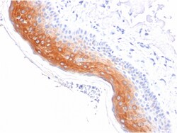 Biotium&nbsp;Cytokeratin 1 (Suprabasal Keratinocyte Marker)(KRT1/1840), CF640R conjugate, 0.1mg/mL