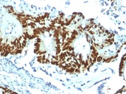 Biotium&nbsp;p53 Tumor Suppressor Protein (TP53/1799R), CF640R conjugate, 0.1mg/mL