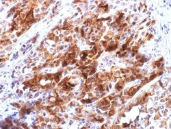 Biotium&nbsp;Glypican-3 (GPC3) (Hepatocellular Carcinoma Marker) (rGPC3/863), CF405S conjugate, 0.1mg/mL