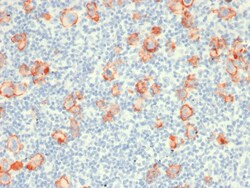 Biotium&nbsp;CD30 / TNFRSF8 (Hodgkin & Reed-Sternberg Cell Marker) (rCD30/412), CF405S conjugate, 0.1mg/mL