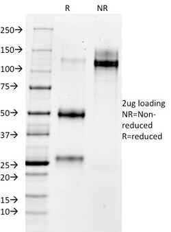 Biotium&nbsp;MMP3 (Marker of Metastasis and Rheumatoid Arthritis)(MMP3/1730), CF405S conjugate, 0.1mg/mL