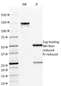 Biotium&nbsp;ETS1 (Marker of Tumor Metastasis)(ETS1/1801), CF405S conjugate, 0.1mg/mL