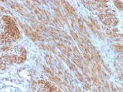 Biotium&nbsp;Desmin (Muscle Cell Marker) (DES/1711), CF405S conjugate, 0.1mg/mL
