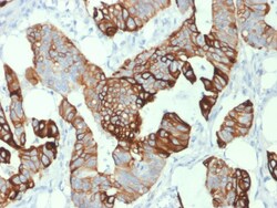 Biotium&nbsp;Cytokeratin 20 (KRT20) (Colorectal Epithelial Marker)(KRT20/1993), 0.2mg/mL