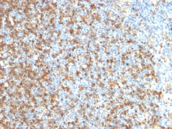 Biotium&nbsp;LMO2 (B-Cell Marker)(LMO2/1971), 0.2mg/mL